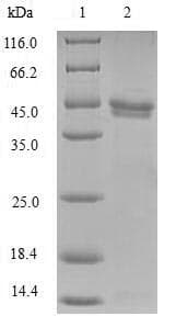Human NDUFB5 Protein (Recombinant 6His-SUMO, N-terminus)
