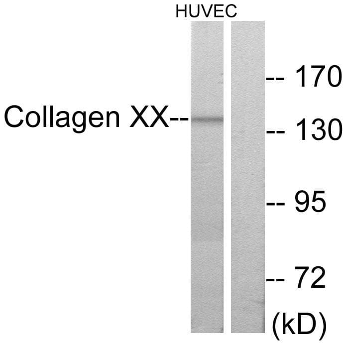 Polyclonal Rabbit anti-Human COL20A1 / Collagen XX Antibody (IHC, IF, WB)