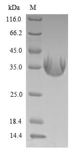 Epstein-Barr Virus LMP1 Protein (Recombinant 10His, N-terminus)