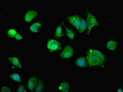 ZDHHC12 Antibody