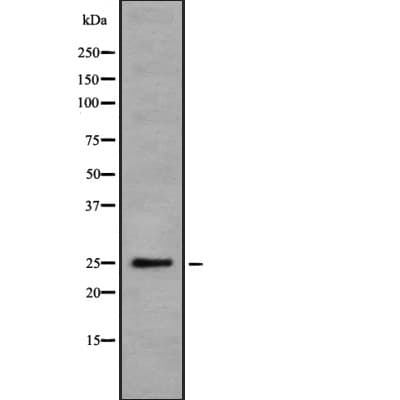 Polyclonal Rabbit anti-Human DDIT4 / REDD1 Antibody (WB)
