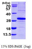 Human SCO2 Protein (Recombinant His)
