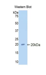 SERPINF2 / Alpha-2-Antiplasmin Antibody (aa348-491)