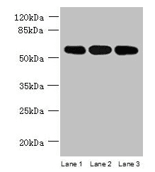 STK33 Antibody