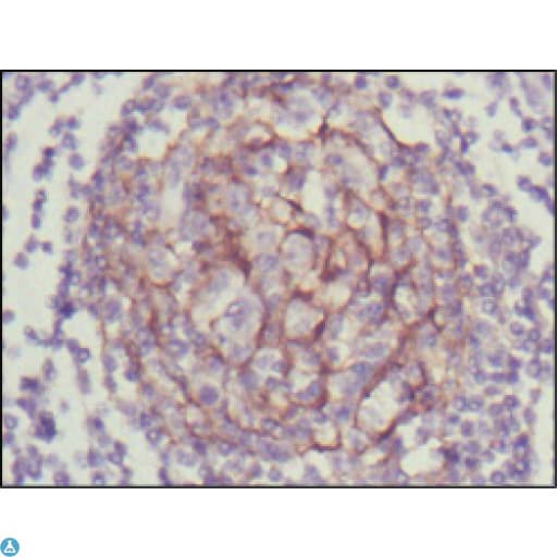 NTRK3 / TRKC Antibody