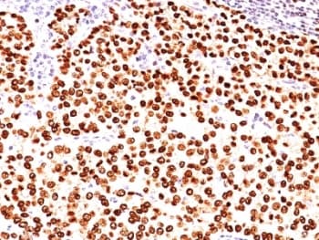 PR / Progesterone Receptor Antibody (clone SPM566)