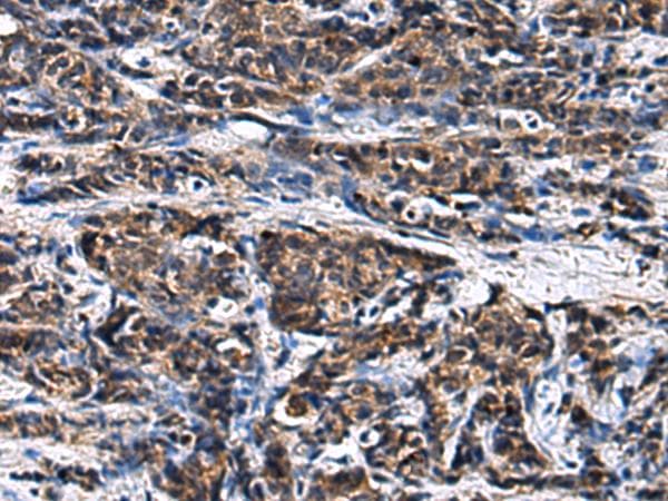 Polyclonal Rabbit anti-Human GANAB / Alpha Glucosidase II Antibody (IHC)