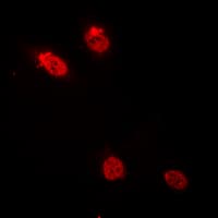 IHC-plus™ MYB / c-Myb Antibody (N-Terminus)