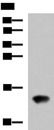 FAM19A4 Antibody
