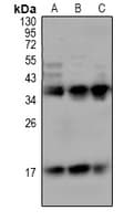 Polyclonal Rabbit anti-Human TREM1 Antibody (IHC, WB)