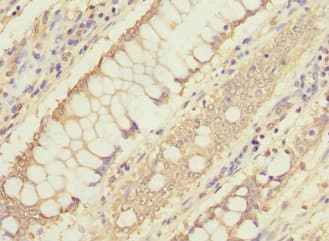 Polyclonal Rabbit anti-Human FTHFSDC1 / MTHFD1L Antibody (IHC, WB)