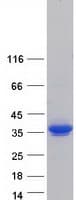 Human KCTD15 Protein (Recombinant Myc-DDK (Flag))