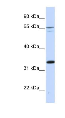 PSIP1 / LEDGF Antibody (C-Terminus)