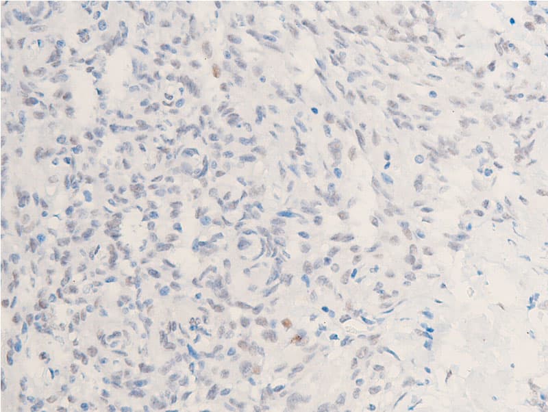 CHEK1 / CHK1 Antibody (phospho-Ser301)
