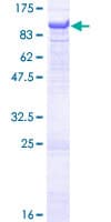Human ACOX2 Protein (Recombinant GST)