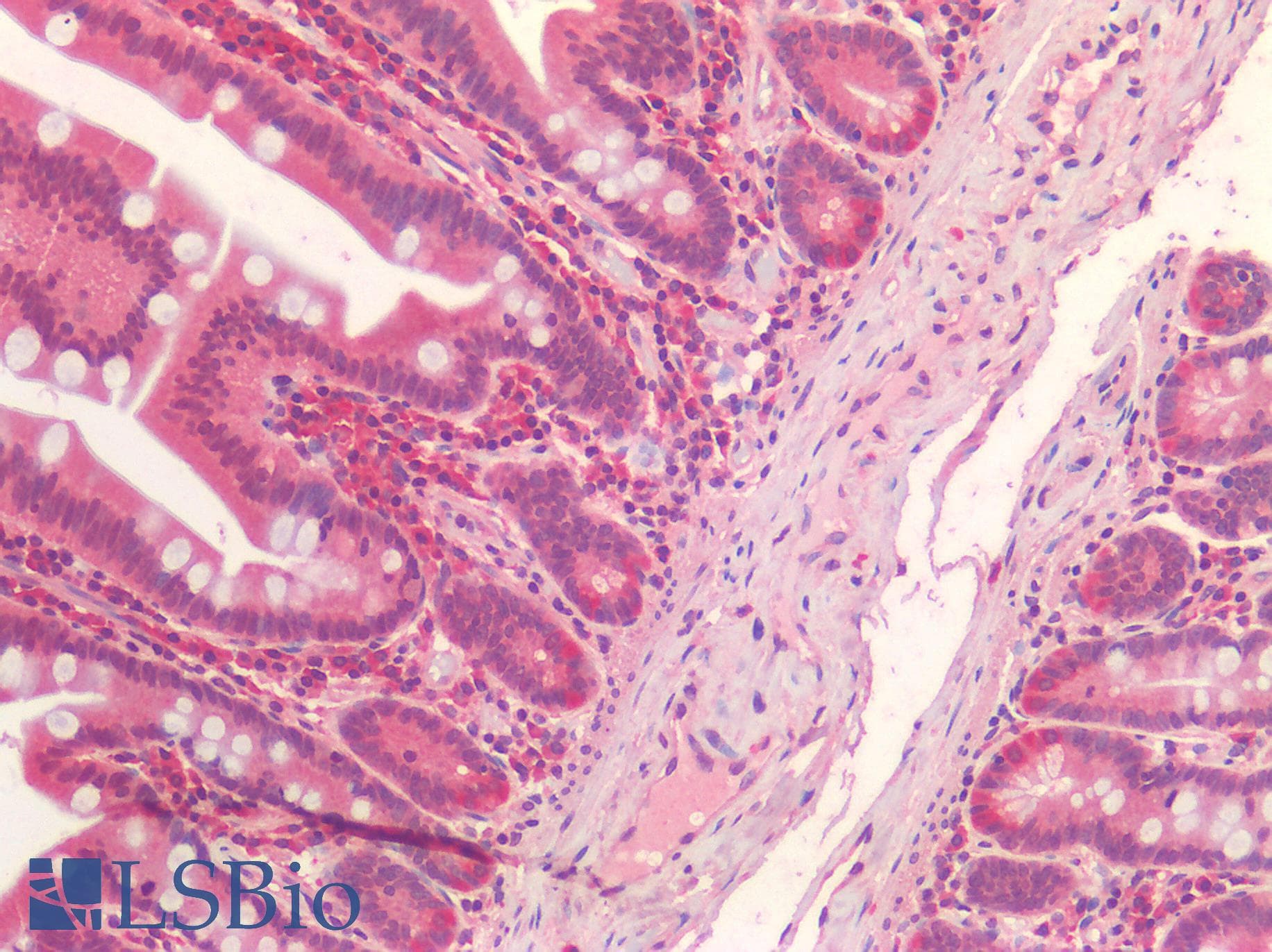 IHC-plus™ Monoclonal Mouse anti-Human IL15RA Antibody (clone 1C5, IHC, WB)