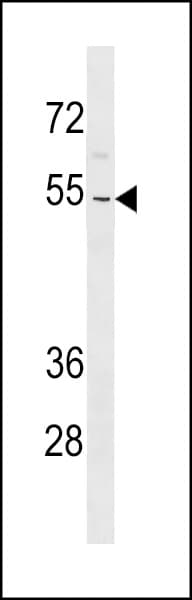ZNF736 Antibody (aa49-75)