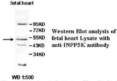 IHC-plus™ INPP5K / SKIP Antibody (aa183-430)