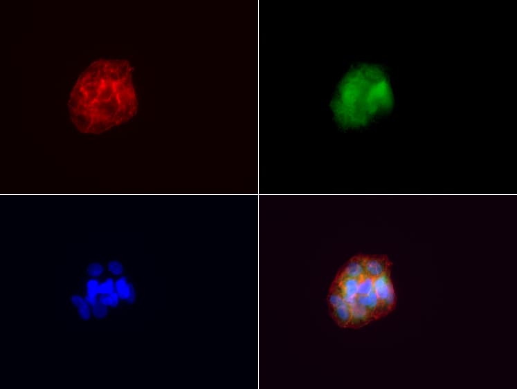VILIP / VSNL1 Antibody (aa2-191, clone UMAB115, Carrier-free)