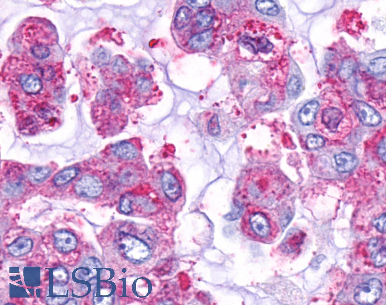 PathPlus™ Polyclonal Rabbit anti-Human GPR161 Antibody (C-Terminus, IHC)