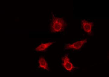 Polyclonal Rabbit anti-Human BCL7A Antibody (IF, WB)