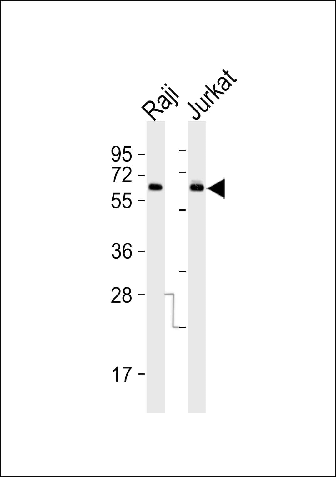 ABCD4 Antibody