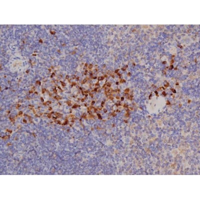 Polyclonal Rabbit anti-Human BCL2L1 / BCL-XL Antibody (phospho-Thr47, IHC, IF, WB)