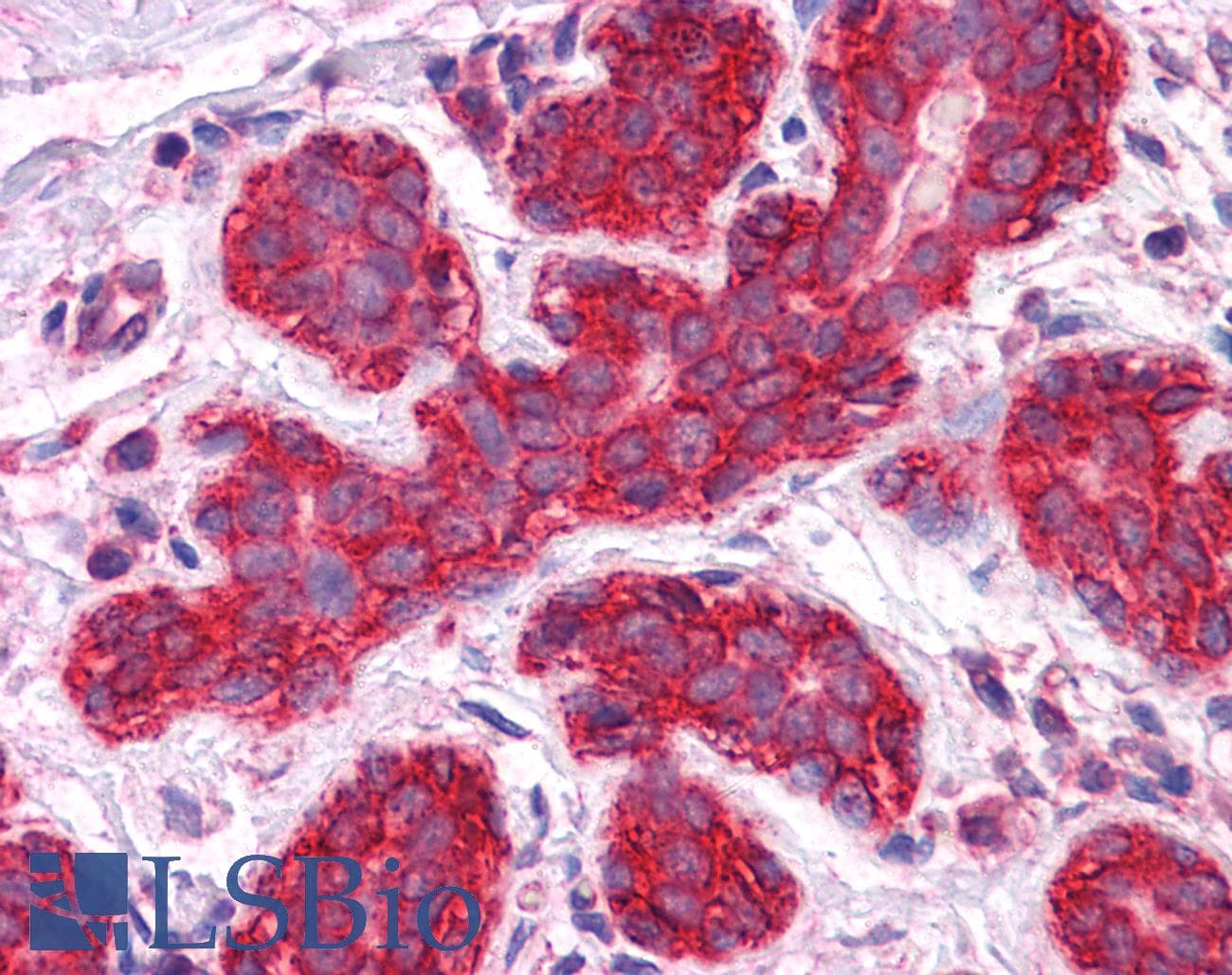 IHC-plus™ Monoclonal Mouse anti-Human JUP/CTNNG/Junction Plakoglobin Antibody (clone 2G9, IHC, IF, WB)