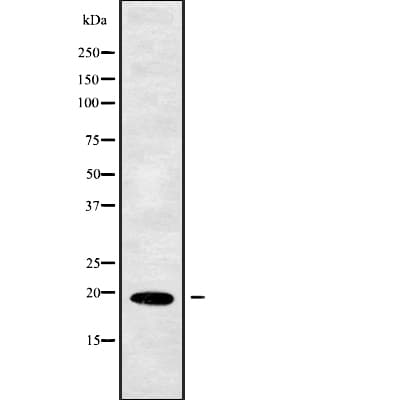 PPP3R1 / Calcineurin B Antibody