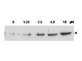 CHEK2 / CHK2 Antibody (phospho-Thr68)