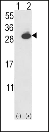 UCHL1 / PGP9.5 Antibody (aa16-46)