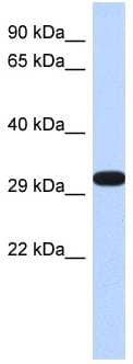 DDAH2 Antibody (N-Terminus)