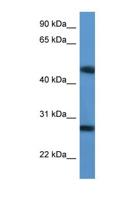 TM2D2 Antibody (aa97-146)