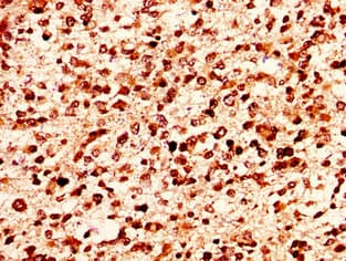 HIST1H1E Antibody