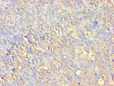 AKT1 Antibody