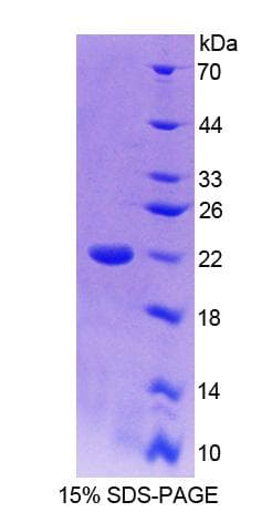 Mouse TRERF1 Protein (Recombinant His-T7)