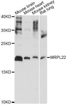 Polyclonal Rabbit anti-Human MRPL22 Antibody (WB)
