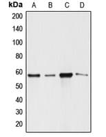Polyclonal Rabbit anti-Human ANGPTL1 Antibody (N-Terminus, WB)