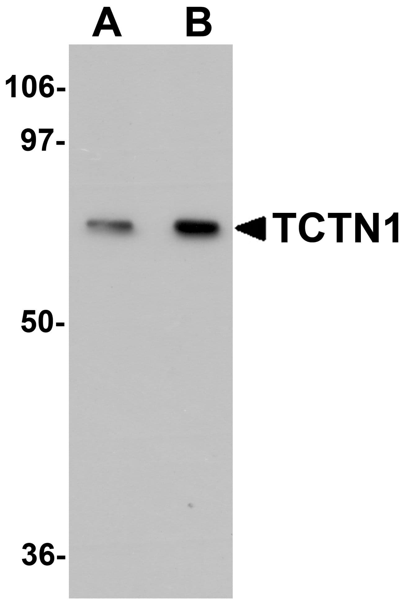 Polyclonal Rabbit anti-Human TCTN1 Antibody (IHC, IF, WB)
