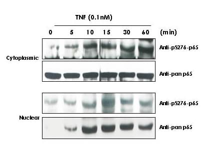 IHC-plus™ Polyclonal Rabbit anti-Human RELA / NFKB p65 Antibody (phospho-Ser529, IHC, WB)