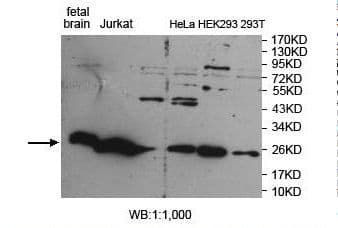 Polyclonal Rabbit anti-Human ARHGDIG / RHOGDI-3 Antibody (aa27-205, IHC, WB)