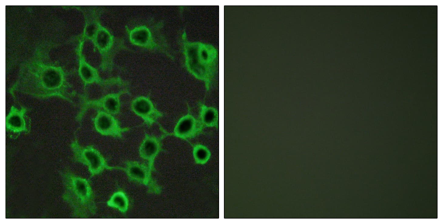 Polyclonal Rabbit anti-Human CCRL2 Antibody (aa141-190, IF, WB)