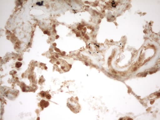 Monoclonal Mouse anti-Human PRMT5 Antibody (clone OTI4G7, aa238-499, IHC)