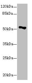 Polyclonal Rabbit anti-Human EIF2S3 / EIF2G Antibody (IHC, WB)