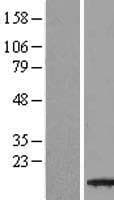 TBCA Protein (Over-Expression Lysate Myc-DDK (Flag))