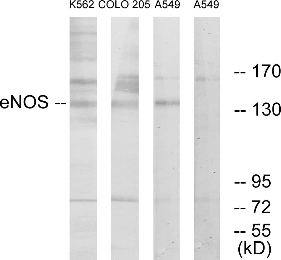 Polyclonal Rabbit anti-Human NOS3 / eNOS Antibody (aa1145-1194, IF, WB)