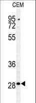 Polyclonal Rabbit anti-Human CASP3 / Caspase 3 Antibody (aa149-179, IHC, WB)
