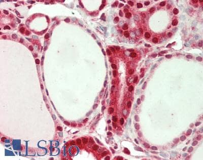 IHC-plus™ ACP1 / Acid Phosphatase Antibody (clone 4B10)