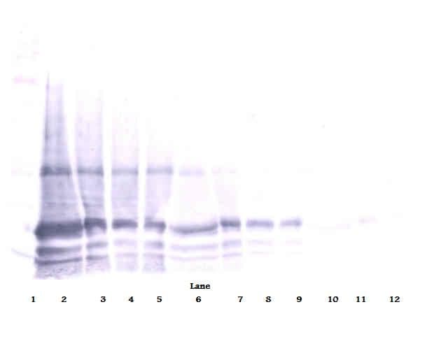 IL6 / Interleukin 6 Antibody