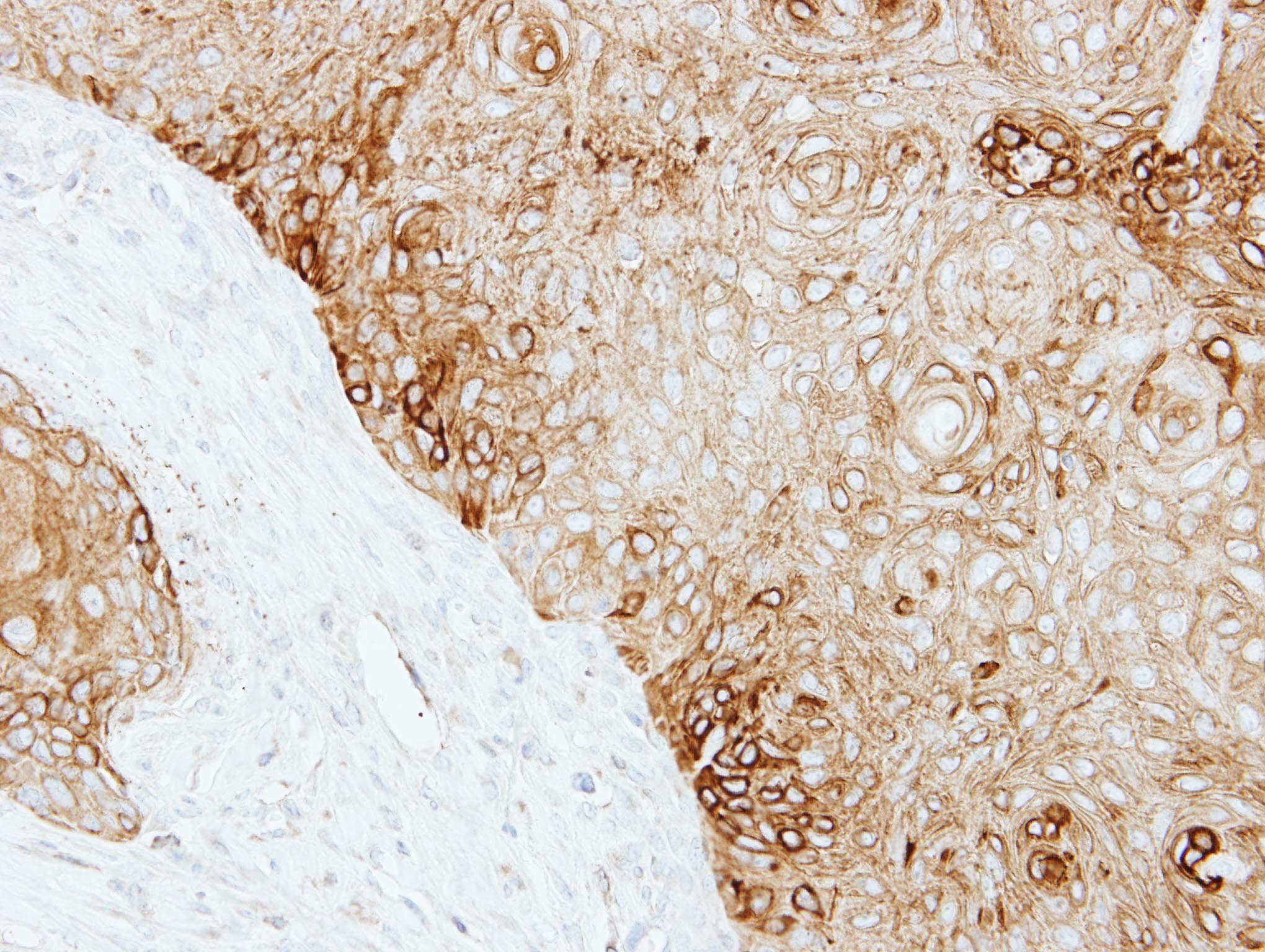 Polyclonal Rabbit anti-Human KRT13 / CK13 / Cytokeratin 13 Antibody (aa198-438, IHC, WB)